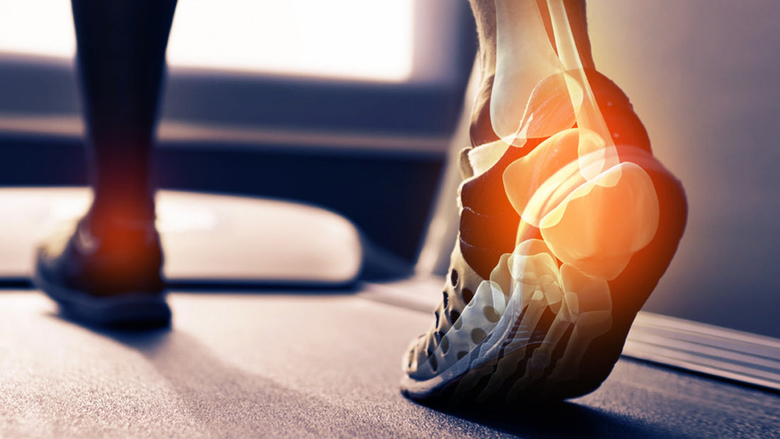 Achilles Tendonitis In Runners: Causes, Prevention, And Treatment